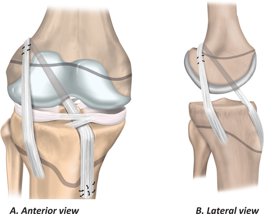 Pediatric Knee Surgery